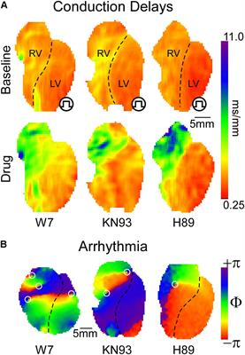 “Heart Oddity”: Intrinsically Reduced Excitability in the Right Ventricle Requires Compensation by Regionally Specific Stress Kinase Function